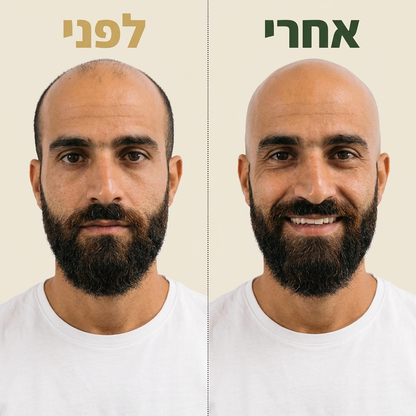 קרחת חלקה ב-90 שניות. בלי גירויים, בלי פציעות ובלי לכלוך