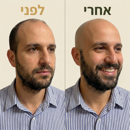 קרחת חלקה ב-90 שניות. בלי גירויים, בלי פציעות ובלי לכלוך